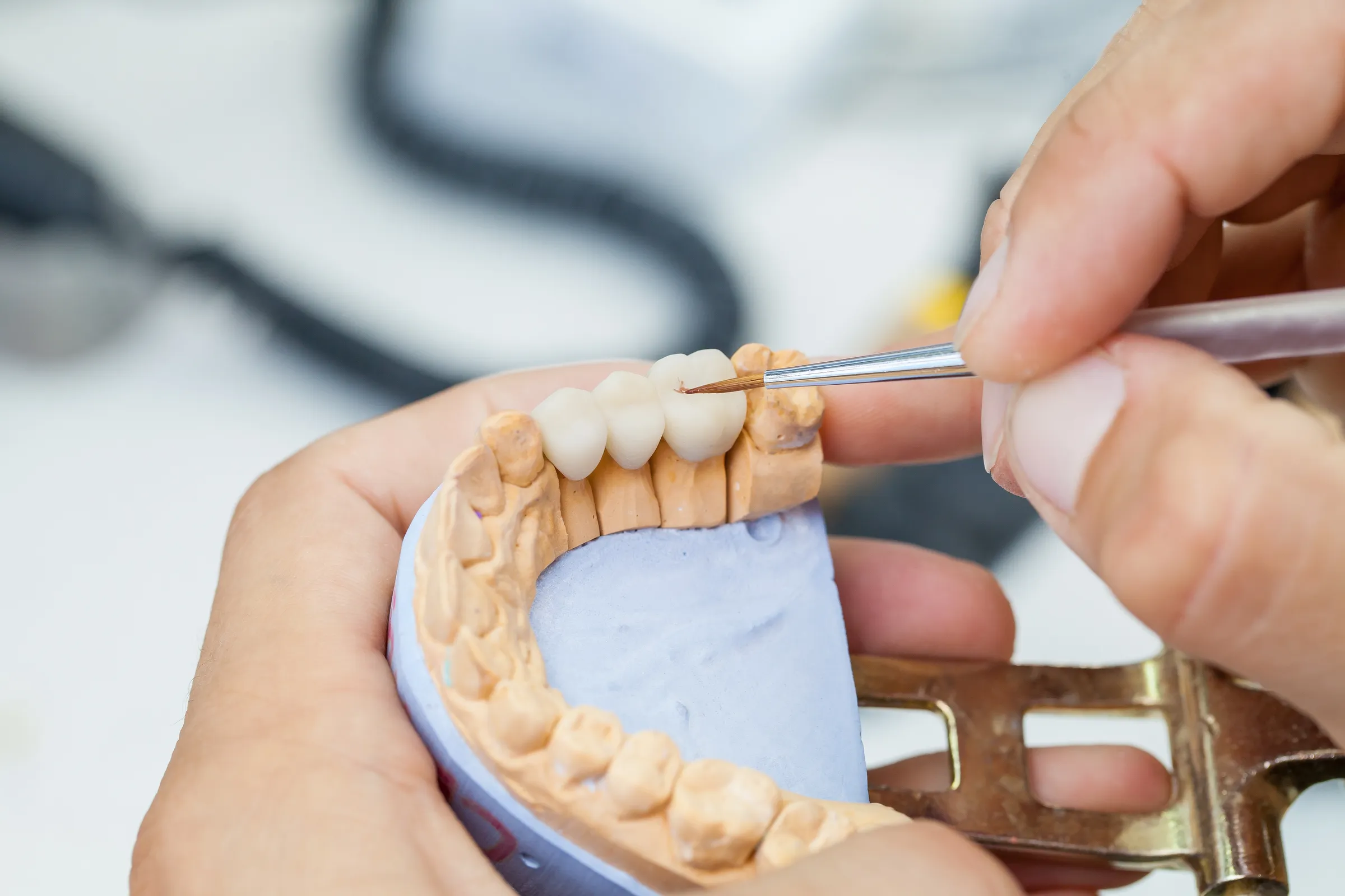 All-ceramic dental crown