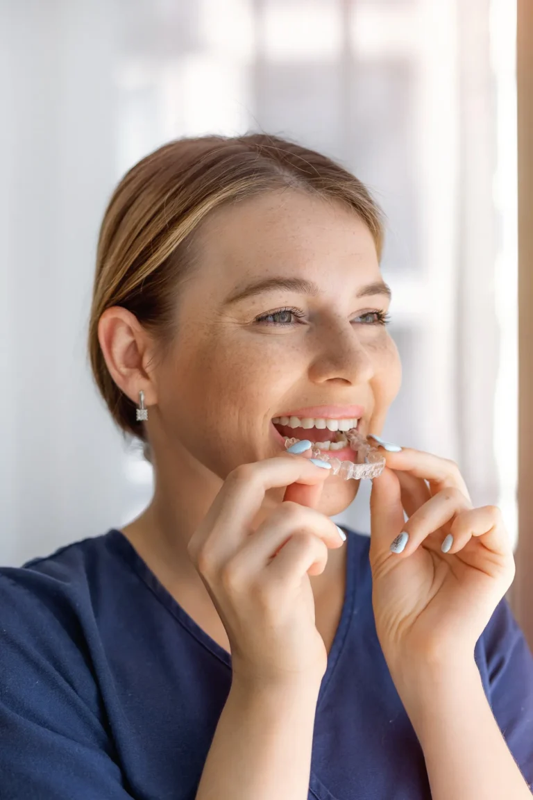 Clear Aligners