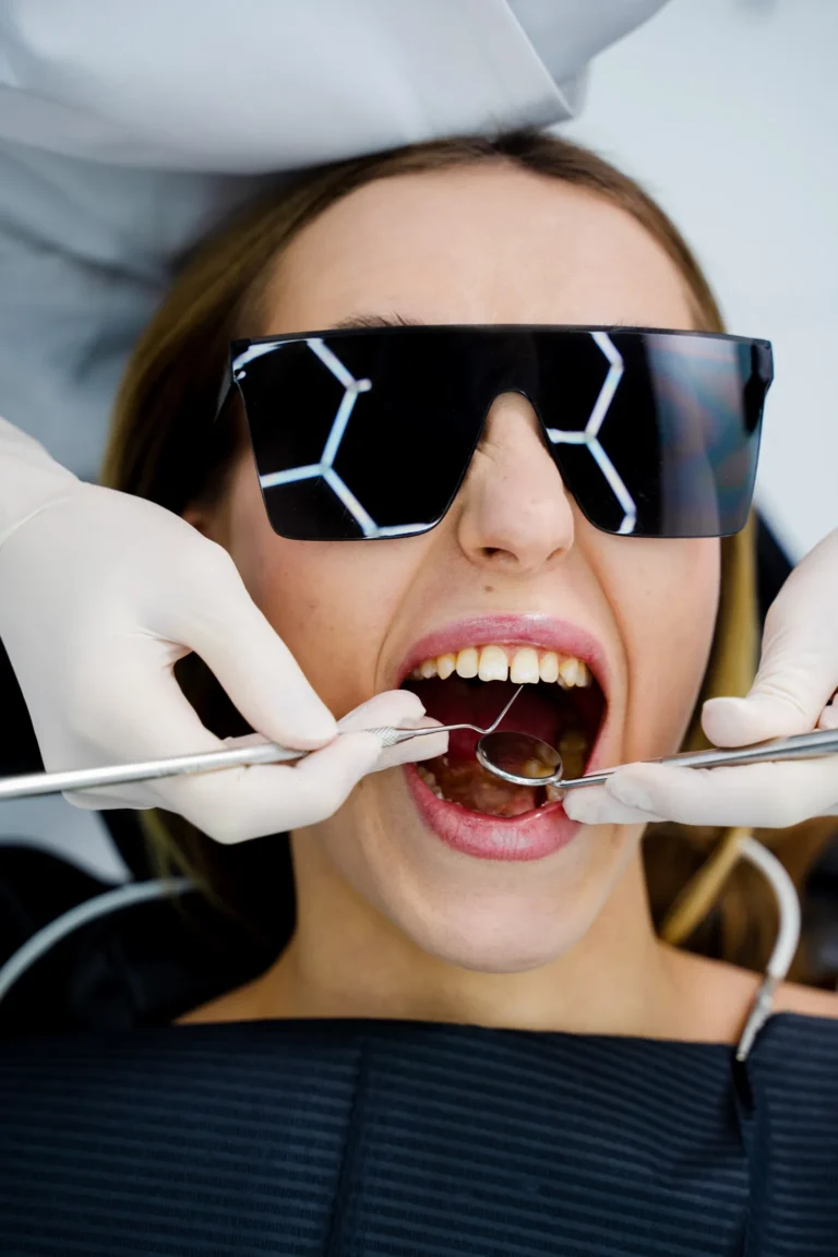 Gingivectomy