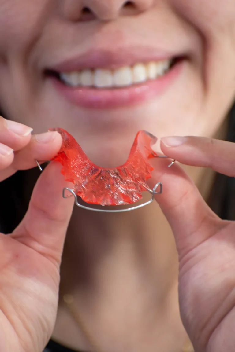Interceptive Orthodontics