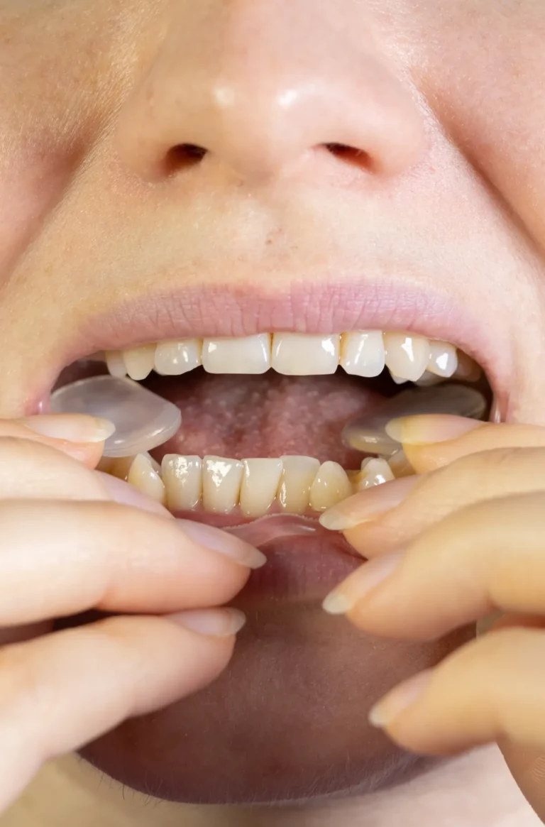TMJ Treatment