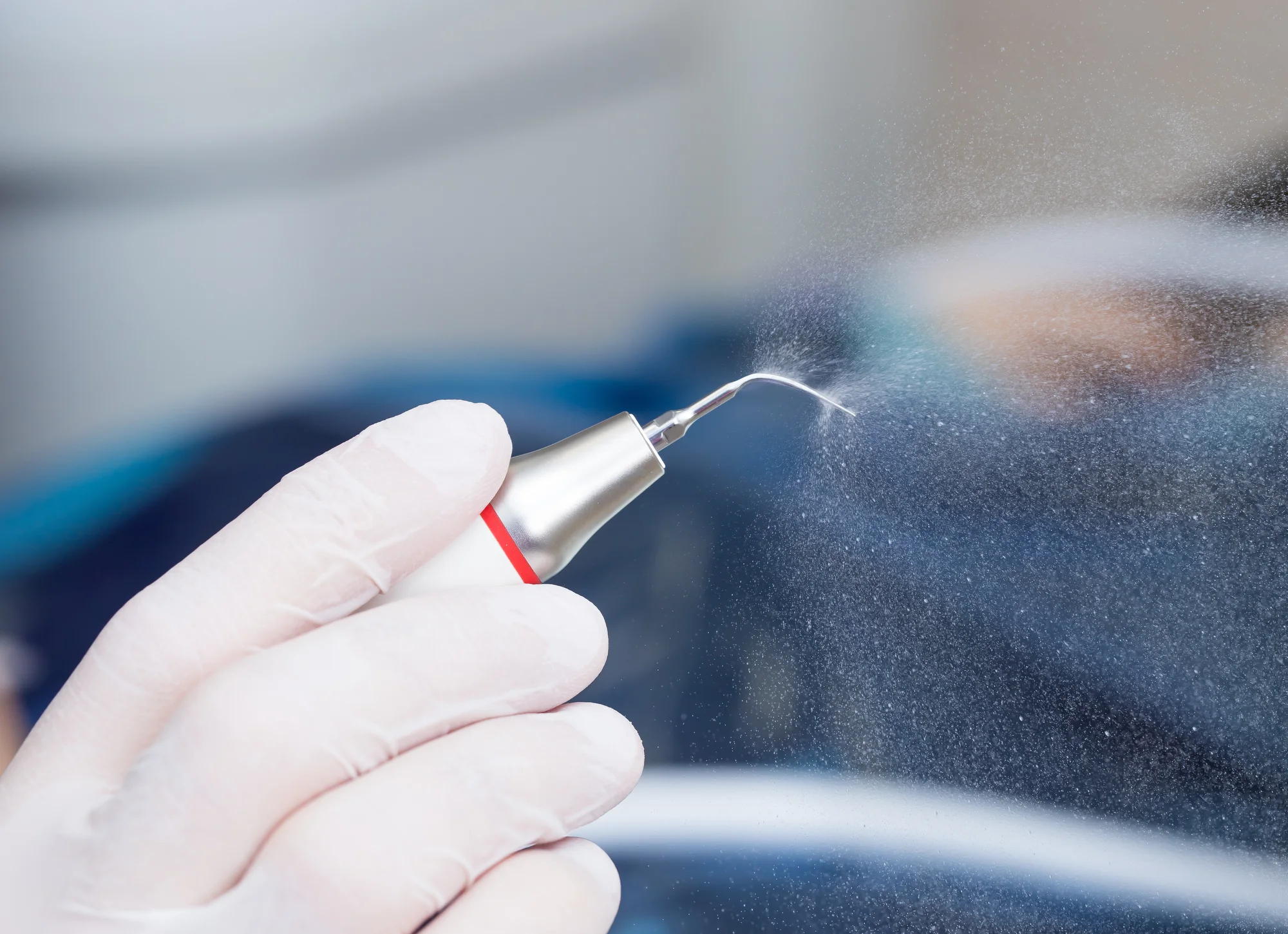 Safe removal of a mercury amalgam filling under isolation in Sarasota, FL